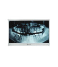 AG Neovo DR-24G 24'' FHD Dental Display LED Monitor - White